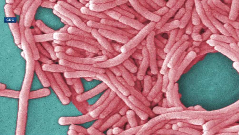 Legionnaire’s disease in two people who stayed at an NH resort hotel