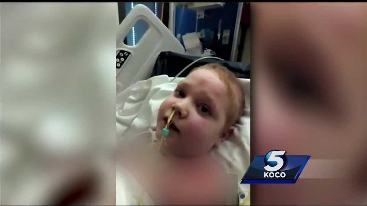 Boy burned in fire posts video update: ‘Thank you for praying for me’