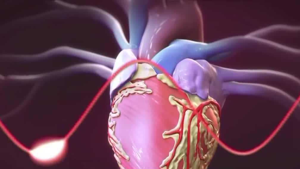 Survey: Many Floridians  don't know they're at increased risk of heart disease