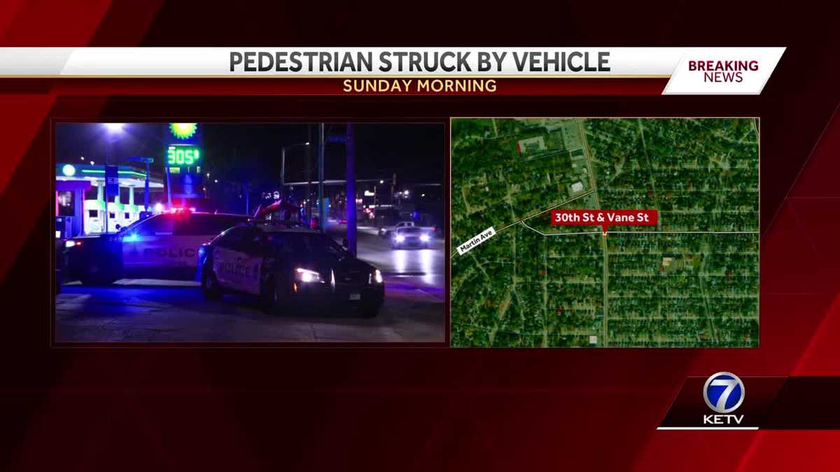 Pedestrian Hit By Car Early Sunday Morning, Suffers Serious Injuries