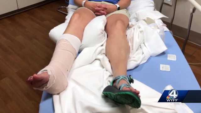 South Carolina: Greenville woman attacked by raccoon on vacation - Vimarsana News