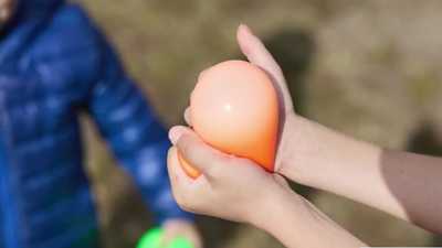 Doctors warn that children are microwaving popular squishy sensory toys – and risking serious burnswbbh
