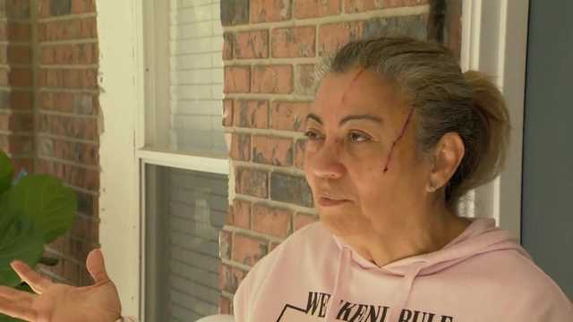 Woman attacked by bear while walking dogs in Florida neighborhood - Vimarsana News