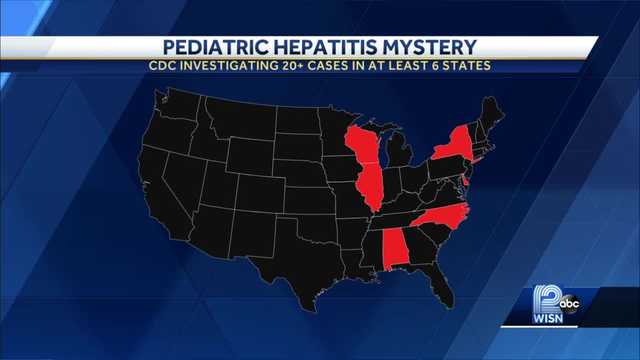 Wisconsin doctors track four mysterious cases of liver damage in children - Vimarsana News