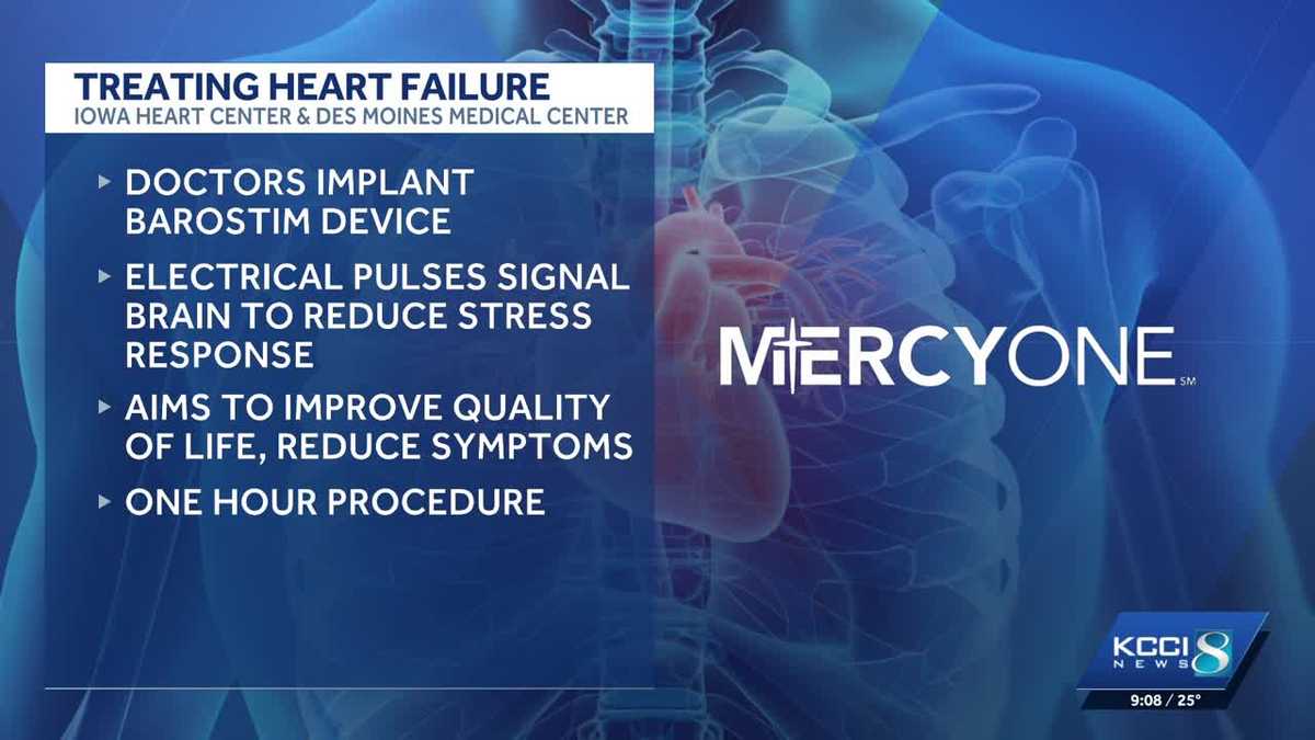 MercyOne uses new technology for heart failure treatment in Iowa