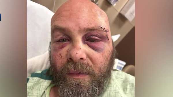 man recovers at des moines hospital following attack at house