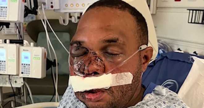 Victim brutally beaten in Lee County jail.