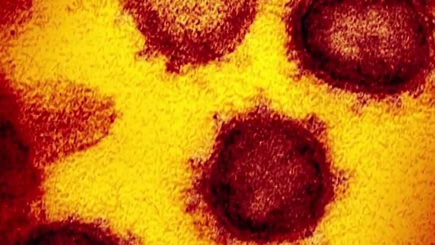 How Long Does The Cold And Flu Virus Stay On Surfaces