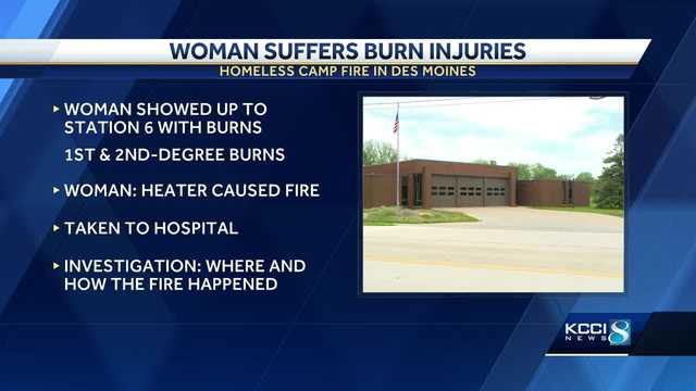 Tent fire leaves Iowa woman with severe burns