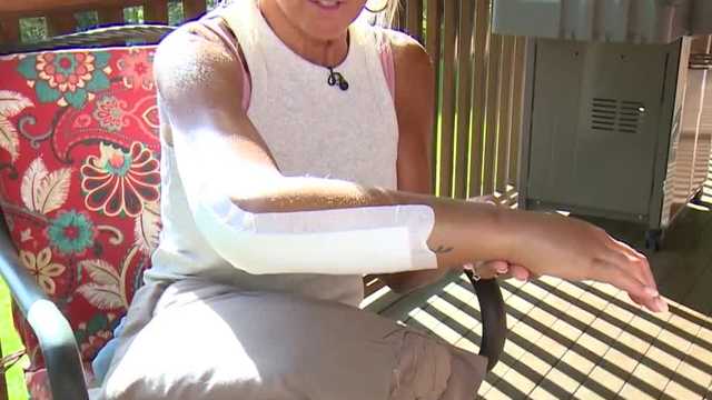 Resort wires money to NH woman injured by elephant bite - Vimarsana News