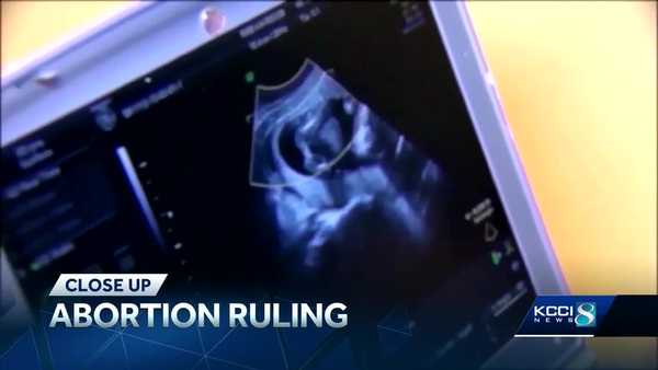 close up: what's next after iowa supreme court decision on state's fetal heartbeat law