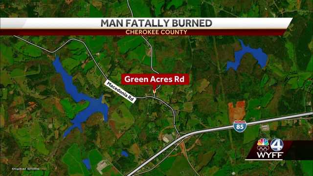 Cherokee County man dies after being severely burned, coroner says - Vimarsana News