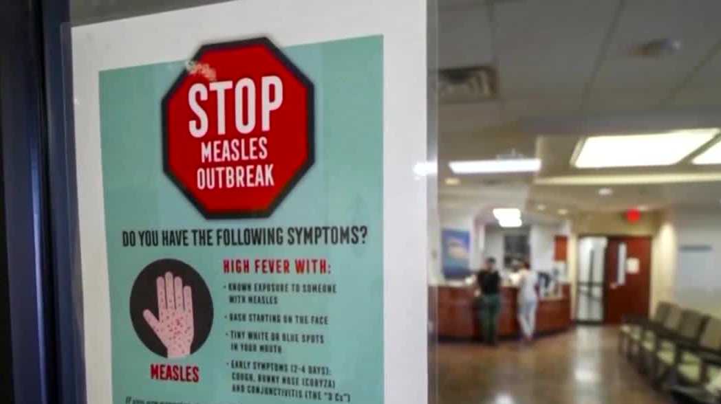 Polk County says Iowa’s first 2026 measles case is no outbreak after 21-day window closes