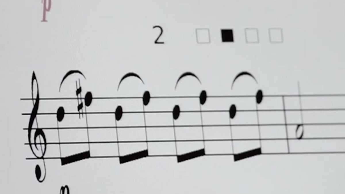 Tech Brings Music Back to Motor-Impaired Musicians
