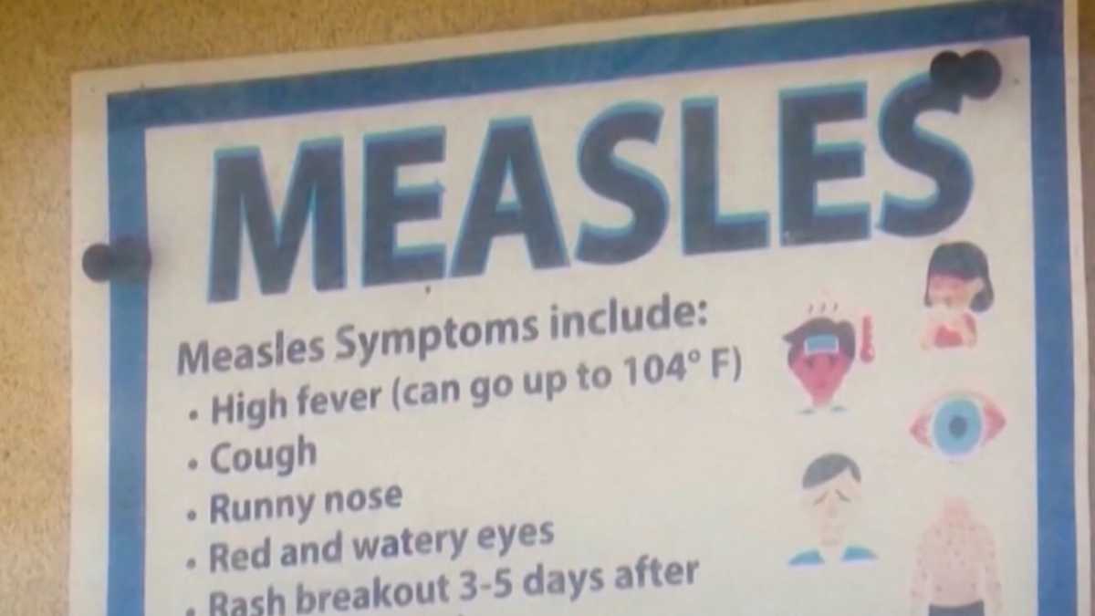 Greenville gym linked to measles case as outbreak spreads in South Carolina