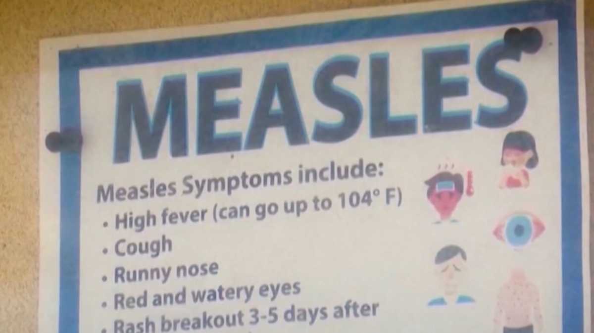 Measles cases in Washington linked to South Carolina outbreak