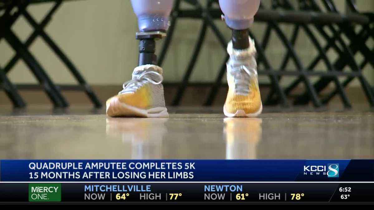 She Did It Quadruple Amputee Completes 5k Walk