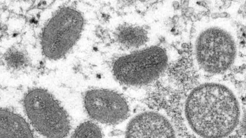 New Hampshire Monkeypox Vaccine Expands Access
