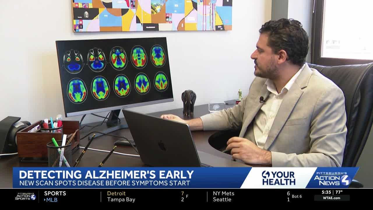 Researchers develop new imaging test to help detect Alzheimer's with greater accuracy