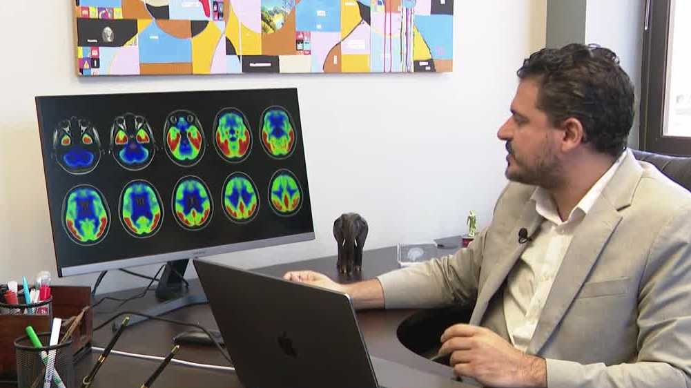 New brain scan may detect Alzheimer’s disease earlier - WJCL