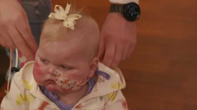 Chloe Clark, 1, waiting for heart transplant at Norton Children's - Vimarsana News