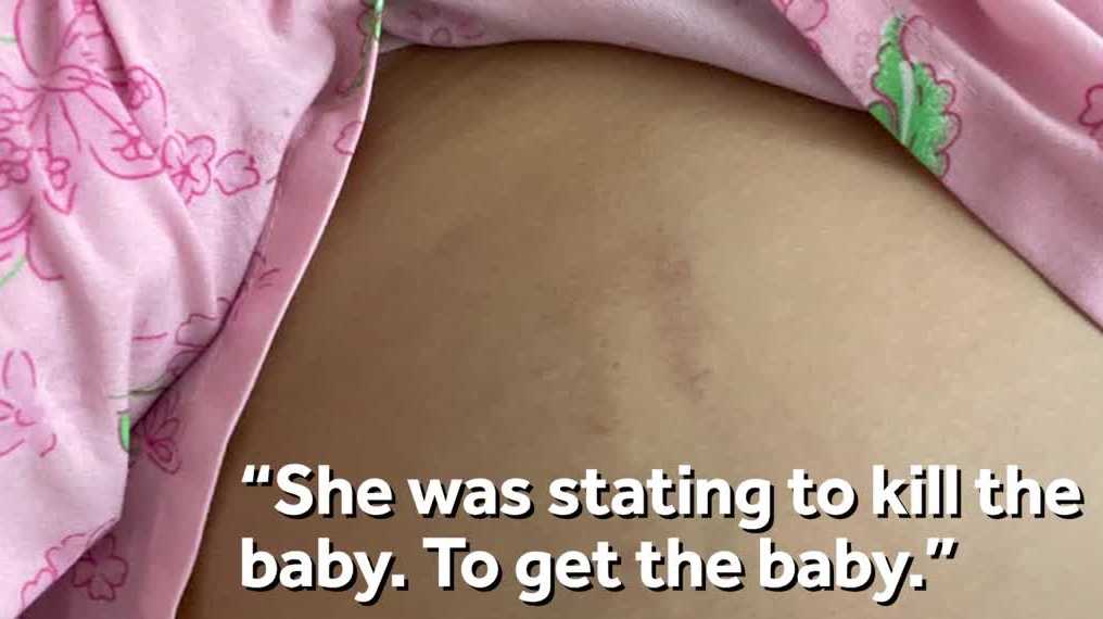 Pregnant woman attacked with bat while leaving work