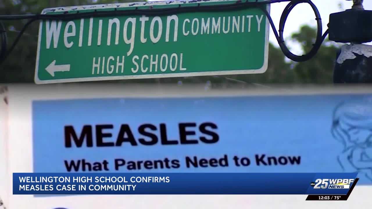 Measles case linked to Wellington High prompts concern; No campus exposure known