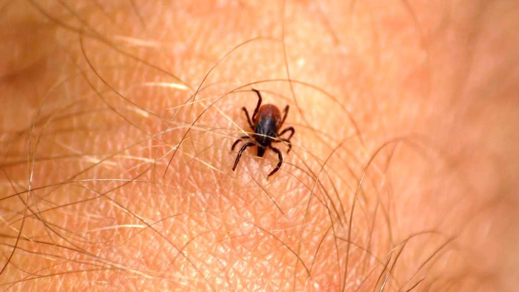 New syndrome added to South Carolina’s reportable diseases list