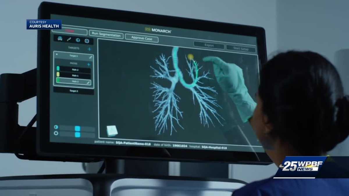 St. Lucie County Medical Center using new technology to diagnose lung cancer