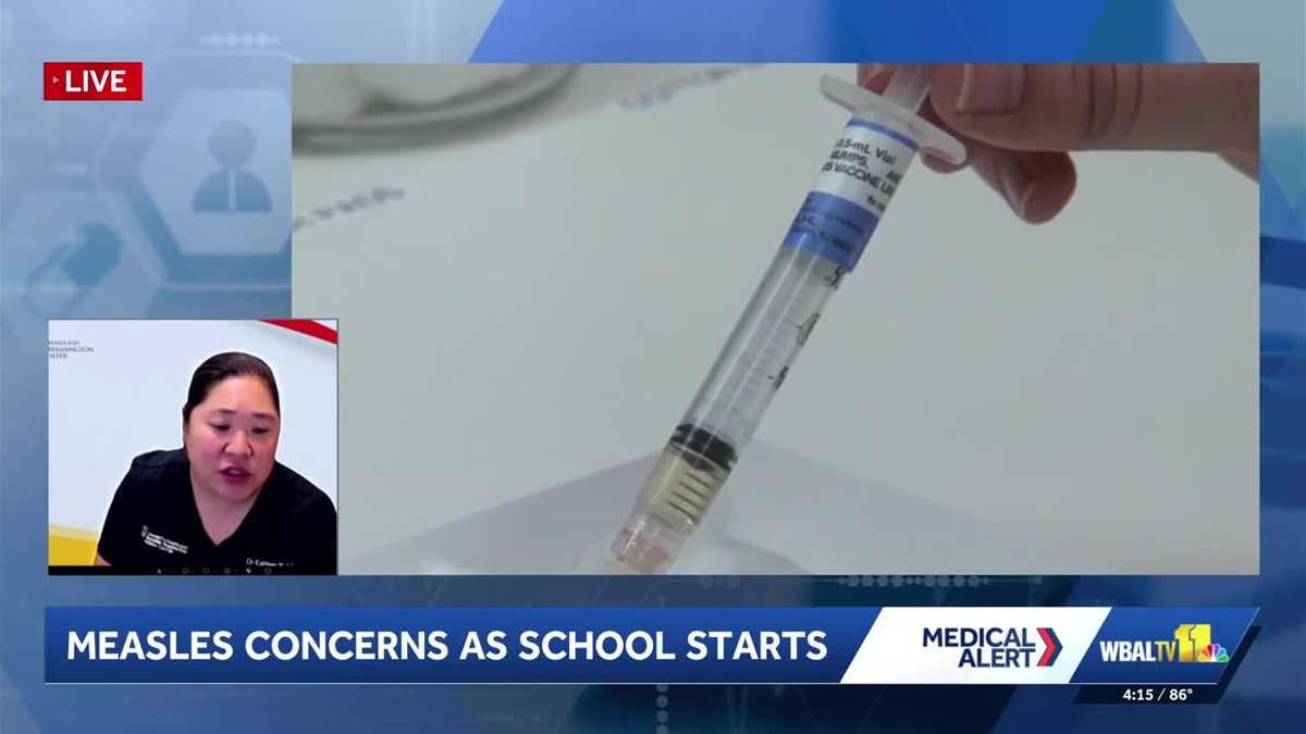 Doctor warns Maryland parents about measles as school starts
