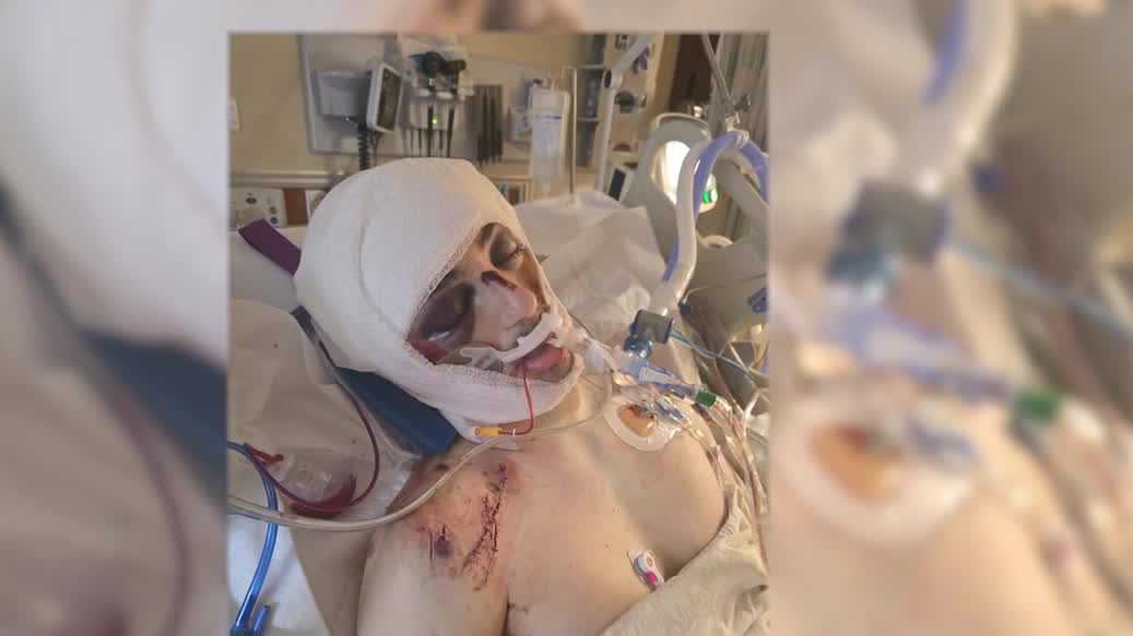 Omaha man, Air Force firefighter recovering at home after hit-and-run in Texas
