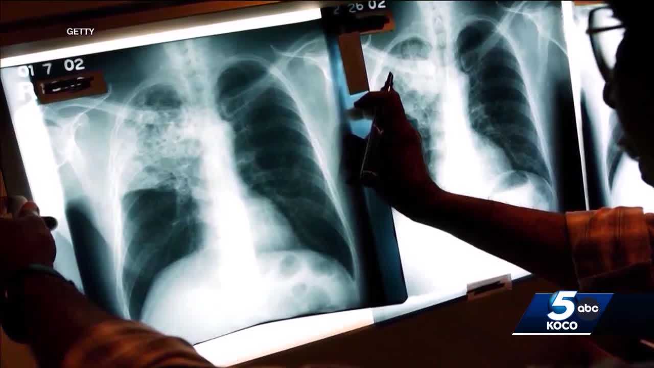高速 割引 2025 西日本 students Enid to exposure tuberculosis potential for tested be 健康・医学