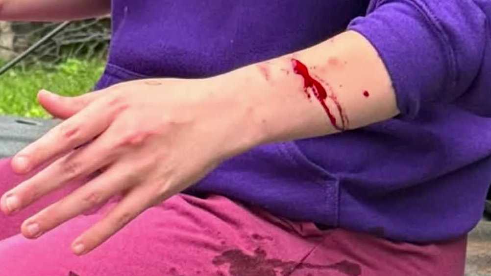 St. Clair Co.. woman says stranger stabbed her as she sat in her car