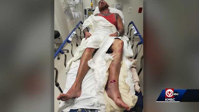 Independence man charged with assault outside Arrowhead Stadium - Vimarsana News
