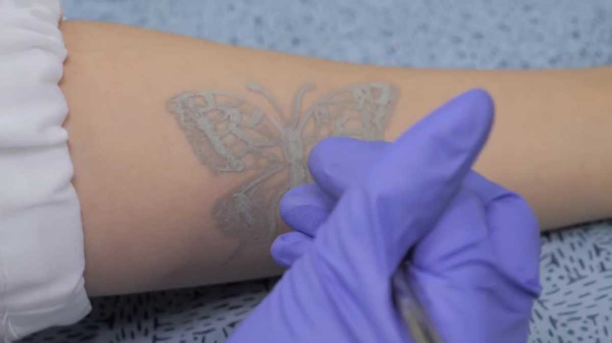 Tatuagens eletrônicas podem monitorar sinais vitais como frequência cardíaca