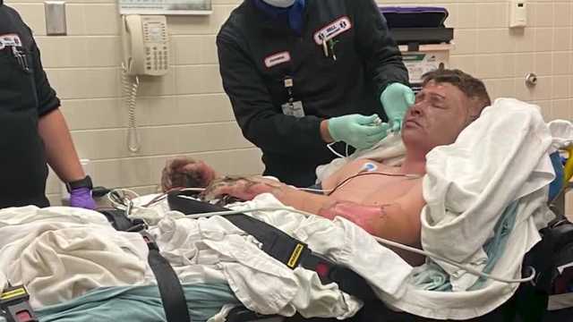 Mother of bonfire explosion survivor says son and others raced to save their friends - Vimarsana News