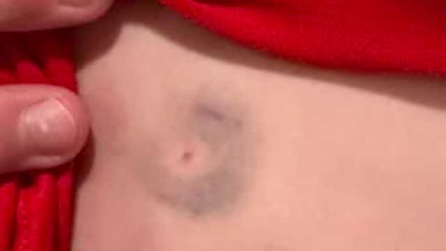 Sheboygan parents ask for safety plan after son stabbed with pencil at school