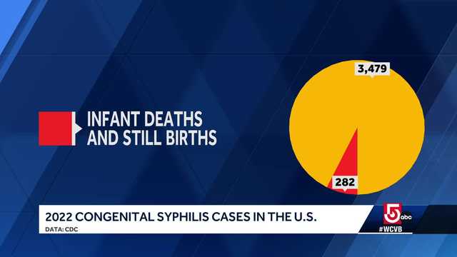 Mass. doctor on increase of babies with syphilis - Vimarsana News