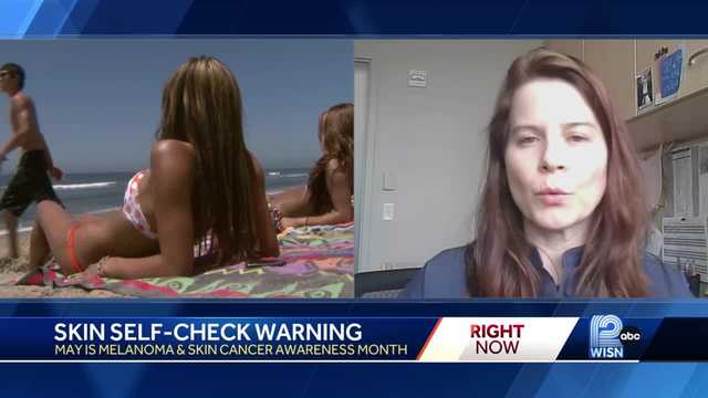 Skin Self Check Warning - Vimarsana News