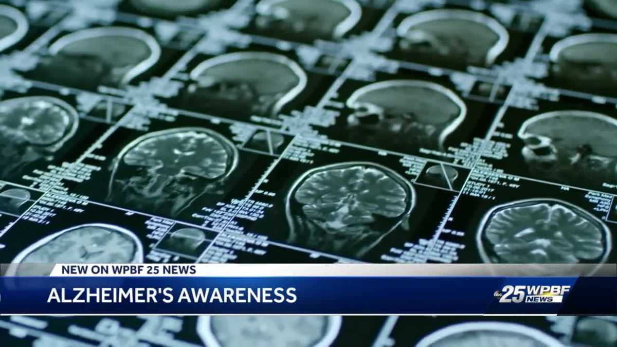Boynton Beach Alzheimer's patient discusses new drug