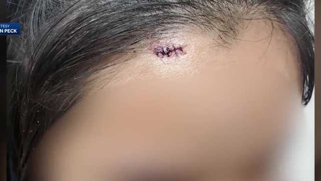 Mother suing Boston Public Schools after she says daughter beaten by bully with Chromebook - Vimarsana News