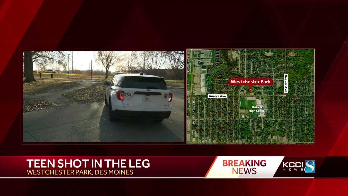 Des Moines police investigating after teen shot in the leg