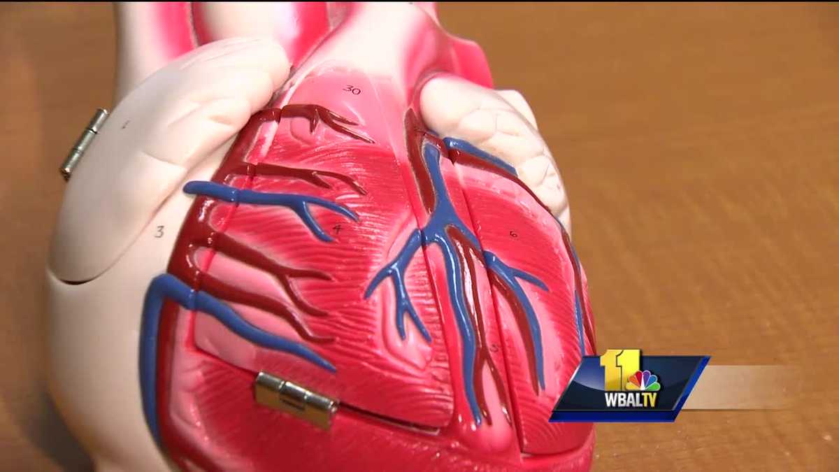 Video: Women's heart attack symptoms differ from men's