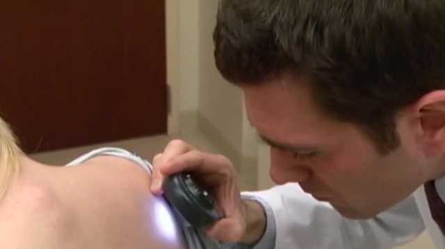 Melanoma Monday raises awareness about invasive skin cancer that many don't even check for