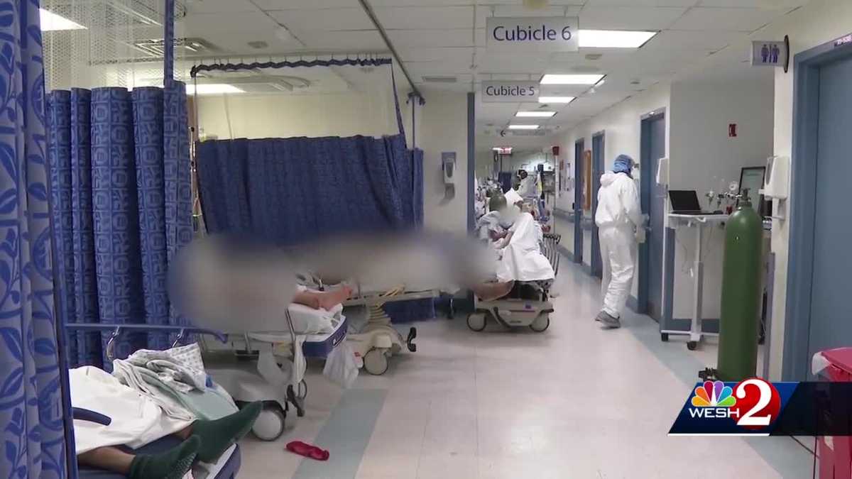 Hair loss added to list of COVID19 impacts on body