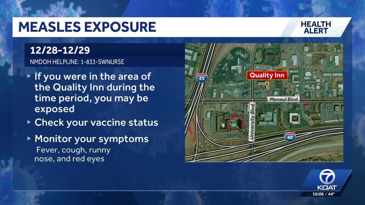 Possible measles exposure reported in Albuquerque