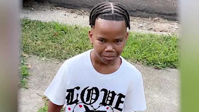 South Carolina mom says hospitalized boy was bit 60 times by dogs - Vimarsana News