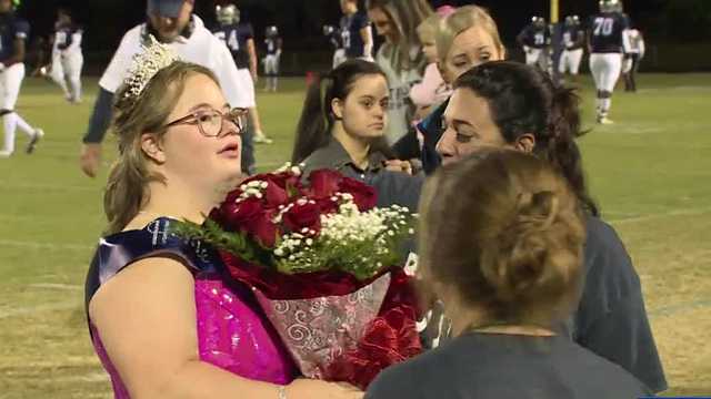 Student with Down syndrome named homecoming queen at North Carolina high school - Vimarsana News