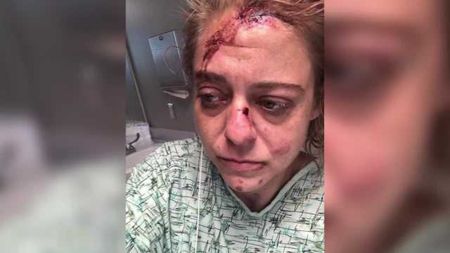 Mother says daughter riding bike was run over, dragged - Vimarsana News