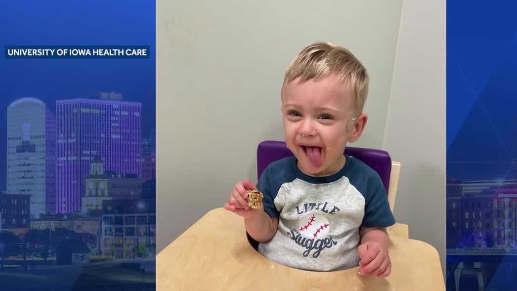 Iowa toddler recognized as world’s most premature baby celebrates second birthday